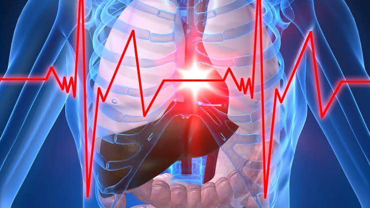 Do you know what is Aase syndrome