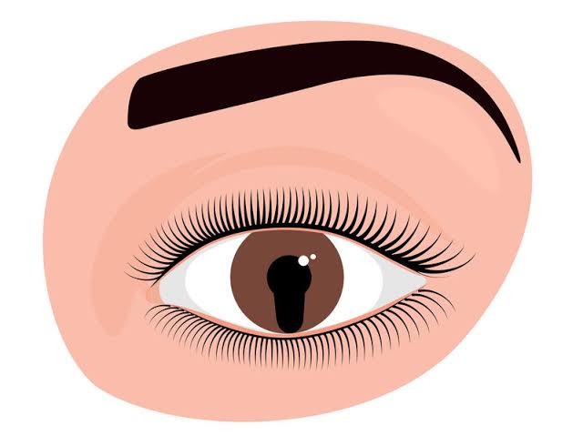Do you know what is Coloboma Syndrome?