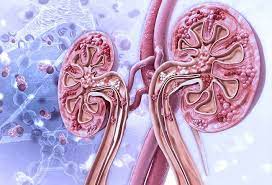 Do you know what is Lupus nephritis